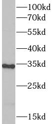 PLAT antibody|PLAT抗体