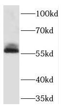 TDG antibody|TDG抗体