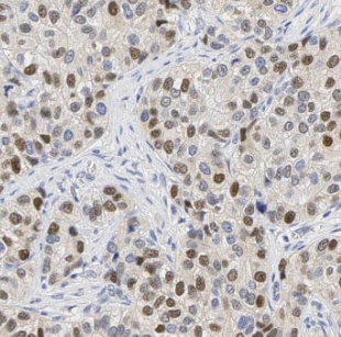 MYEF2 antibody|MYEF2抗体