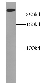 MTOR antibody|MTOR抗体 FNab05417