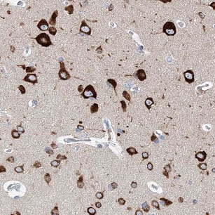 NECAB2 antibody|NECAB2抗体