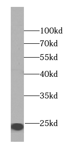 CAPS antibody|CAPS抗体