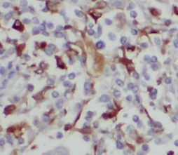 BAGE4 antibody|BAGE4抗体