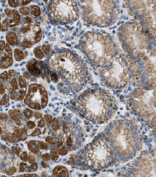 MRPS2 antibody|MRPS2抗体