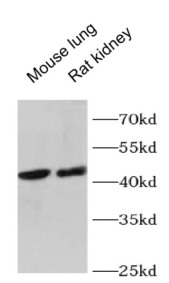 GNA13 antibody|GNA13抗体