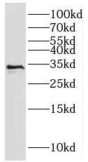 RNASEH2A antibody|RNASEH2A抗体