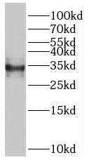 RSPH9 antibody|RSPH9抗体
