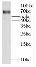 SLC20A2 antibody|SLC20A2抗体