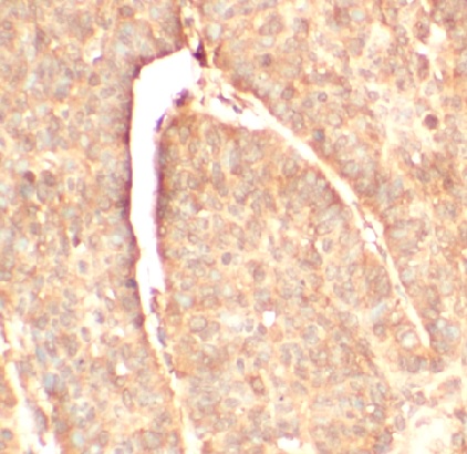 CFH antibody|CFH抗体