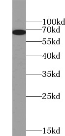 RYK antibody|RYK抗体