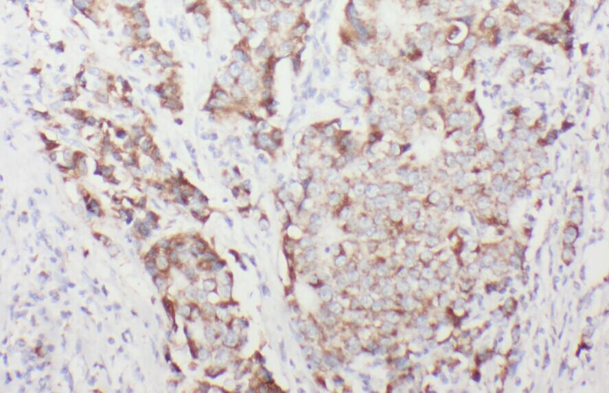 ACADSB antibody|ACADSB抗体