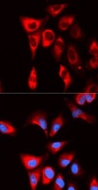EIF4B antibody|EIF4B抗体