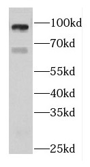 DIS3L2 antibody|DIS3L2抗体