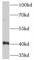 TOB1 antibody|TOB1抗体