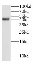 GTF2H2C antibody|GTF2H2C抗体
