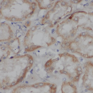 TSLP antibody|TSLP抗体