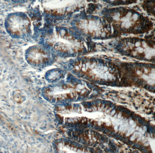 FIBCD1 antibody|FIBCD1抗体