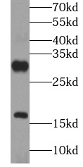 GRP antibody|GRP抗体