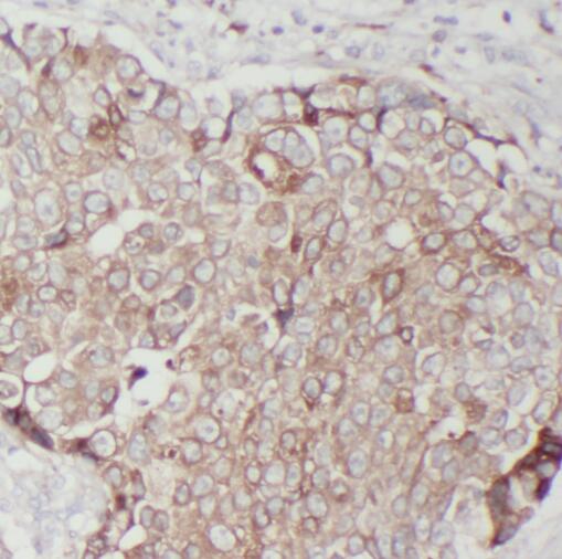 TMEM199 antibody|TMEM199抗体