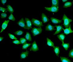 UCN2 antibody|UCN2抗体