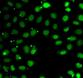 SUB1 antibody|SUB1抗体 FNab08367