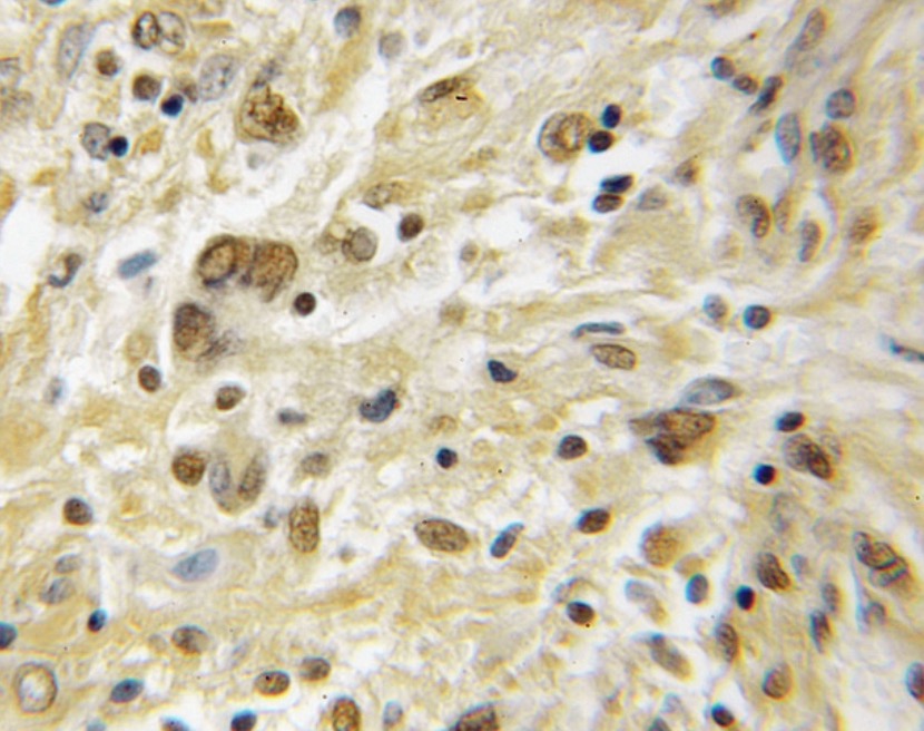 PRKACB antibody|PRKACB抗体