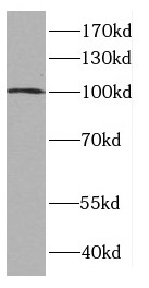 CTNNA3 antibody|CTNNA3抗体