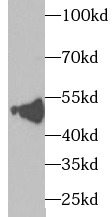 TXNDC5 antibody|TXNDC5抗体