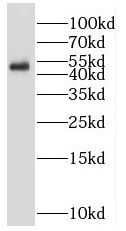 RNF167 antibody|RNF167抗体