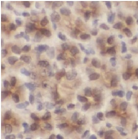 MAP2K6 antibody|MAP2K6抗体 FNab0