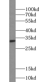 ULBP2 antibody|ULBP2抗体