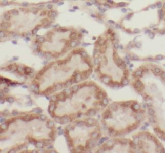 TFAM antibody|TFAM抗体 FNab08615