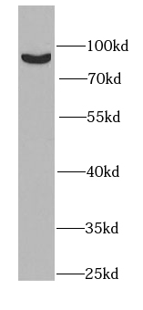 PLA2G6 antibody|PLA2G6抗体