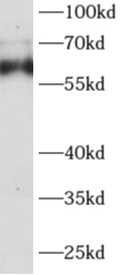 AGFG1 antibody|AGFG1抗体