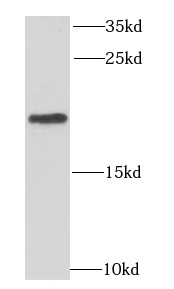MRPL11 antibody|MRPL11抗体