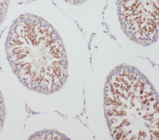 TPTE antibody|TPTE抗体