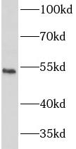 IFNAR2 antibody|IFNAR2抗体