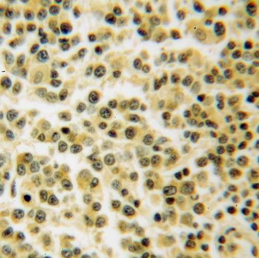 TNIP1 antibody|TNIP1抗体