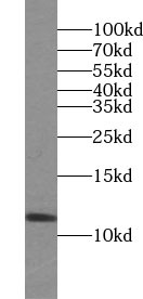 SUMO2/3 antibody|SUMO2/3抗体 FNa
