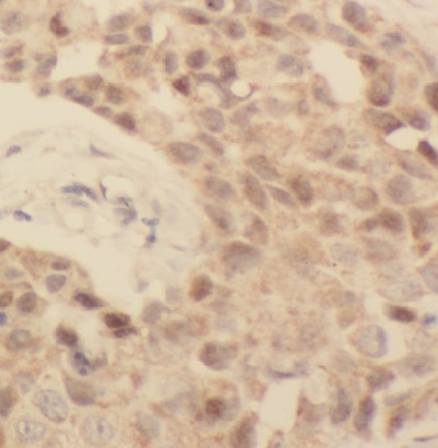 EAF2 antibody|EAF2抗体
