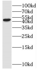 SH2D5 antibody|SH2D5抗体