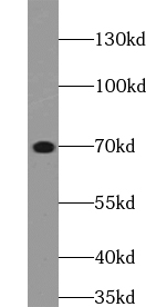 ZFP64 antibody|ZFP64抗体