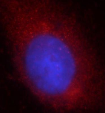 TOMM40 antibody|TOMM40抗体 FNab0