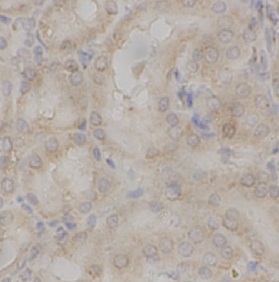 KLF4 antibody|KLF4抗体 FNab10038