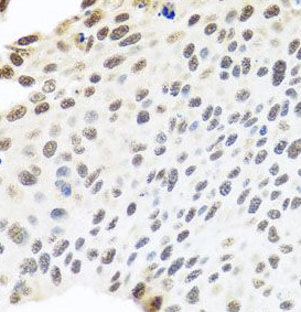 MTREX antibody|MTREX抗体