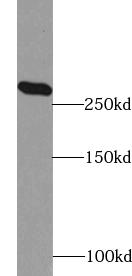 ACACA antibody|ACACA抗体