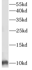 S100A6 antibody|S100A6抗体 FNab0