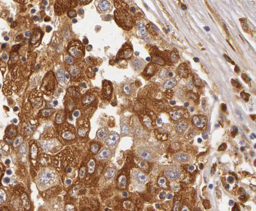 PXN antibody|PXN抗体 FNab06178