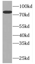 PLK2 antibody|PLK2抗体