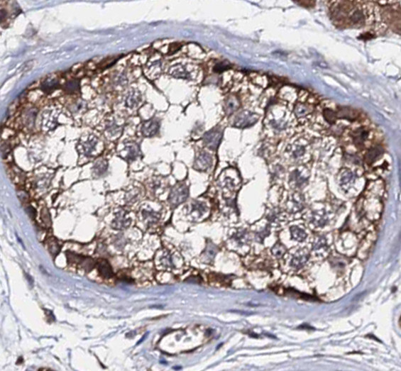 RNF133 antibody|RNF133抗体